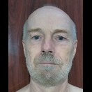 Bei bewegtem Wasser filtert der Bart Schwebstoffe